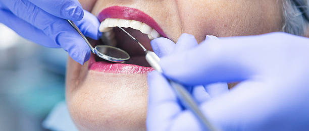 Best Broken or Chipped Tooth Repair in Pilot Point, TX